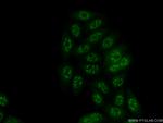 ETV5 Antibody in Immunocytochemistry (ICC/IF)