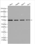 ETV5 Antibody in Western Blot (WB)