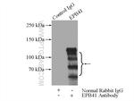 EPB41 Antibody in Immunoprecipitation (IP)