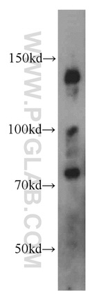 EPB41 Antibody in Western Blot (WB)