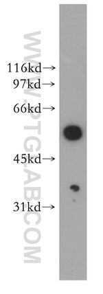 DBNL Antibody in Western Blot (WB)