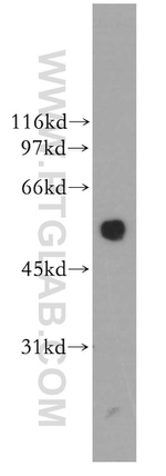 DBNL Antibody in Western Blot (WB)