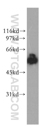 DBNL Antibody in Western Blot (WB)