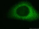 DBNL Antibody in Immunocytochemistry (ICC/IF)