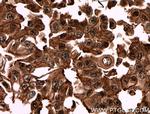 DBNL Antibody in Immunohistochemistry (Paraffin) (IHC (P))