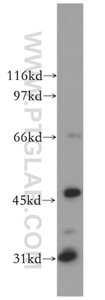 TFAP2A/AP-2 Antibody in Western Blot (WB)