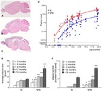 Amyloid Precursor Protein Antibody in Immunohistochemistry (IHC)