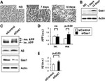 Amyloid Precursor Protein Antibody in Western Blot (WB)