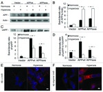 Amyloid Precursor Protein Antibody in Western Blot (WB)