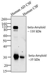 Amyloid Precursor Protein Antibody