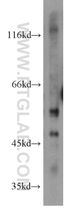 ENTPD3 Antibody in Western Blot (WB)