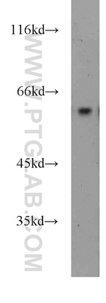 ENTPD3 Antibody in Western Blot (WB)