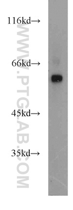 ENTPD3 Antibody in Western Blot (WB)