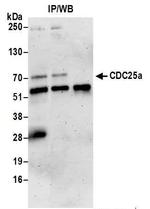 CDC25a Antibody in Western Blot (WB)