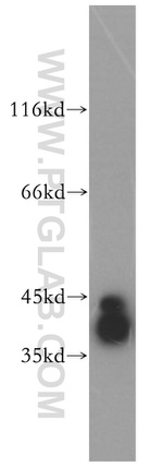 RRAGB Antibody in Western Blot (WB)