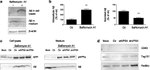 Amyloid Precursor Protein Antibody in Western Blot (WB)