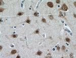 HuA/B/C/D Antibody in Immunohistochemistry (Paraffin) (IHC (P))