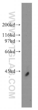 HuA/B/C/D Antibody in Western Blot (WB)