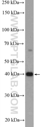 HuA/B/C/D Antibody in Western Blot (WB)