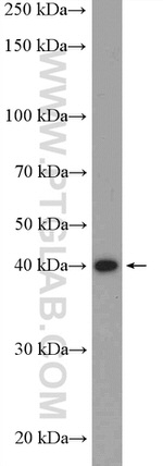 HuA/B/C/D Antibody in Western Blot (WB)