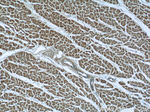 SACM1L Antibody in Immunohistochemistry (Paraffin) (IHC (P))