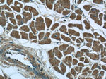 SACM1L Antibody in Immunohistochemistry (Paraffin) (IHC (P))