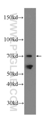 SACM1L Antibody in Western Blot (WB)