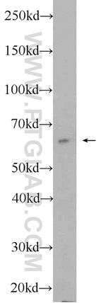 SACM1L Antibody in Western Blot (WB)