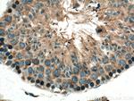 TRIM37 Antibody in Immunohistochemistry (Paraffin) (IHC (P))