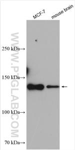 TRIM37 Antibody in Western Blot (WB)