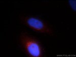 FGFR2 Antibody in Immunocytochemistry (ICC/IF)