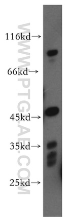 FGFR2 Antibody in Western Blot (WB)