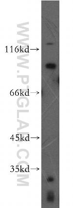 FGFR2 Antibody in Western Blot (WB)