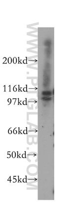 MCM4 Antibody in Western Blot (WB)