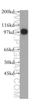 MCM4 Antibody in Western Blot (WB)