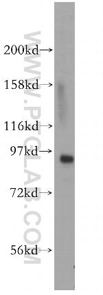 MCM4 Antibody in Western Blot (WB)