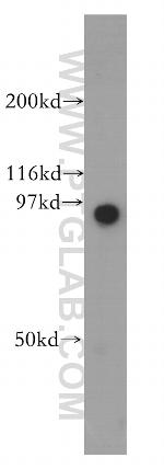 GNS Antibody in Western Blot (WB)