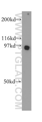 GNS Antibody in Western Blot (WB)