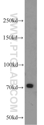 PLEKHA5 Antibody in Western Blot (WB)