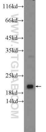 ARL8B Antibody in Western Blot (WB)