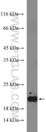 ARL8B Antibody in Western Blot (WB)