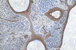 Claudin 1 Antibody in Immunohistochemistry (Paraffin) (IHC (P))