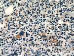 RAB37 Antibody in Immunohistochemistry (Paraffin) (IHC (P))