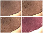 CD309 (FLK1) Antibody in Immunohistochemistry (IHC)