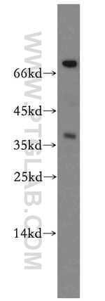 ASPRV1 Antibody in Western Blot (WB)