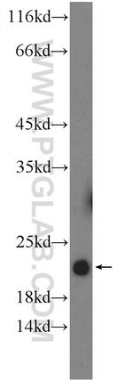 THRSP Antibody in Western Blot (WB)