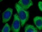 G3BP1 Antibody in Immunocytochemistry (ICC/IF)