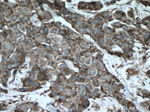 G3BP1 Antibody in Immunohistochemistry (Paraffin) (IHC (P))