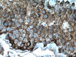 G3BP1 Antibody in Immunohistochemistry (Paraffin) (IHC (P))