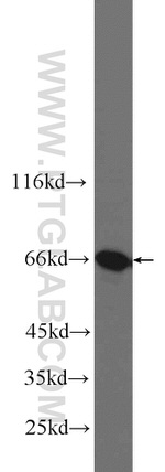 G3BP1 Antibody in Western Blot (WB)